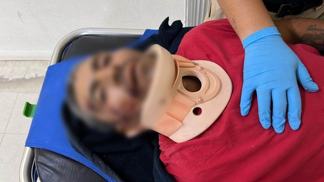 ZAMORA Vehículo desconocido arrolla a hombre y huye en Zamora 1