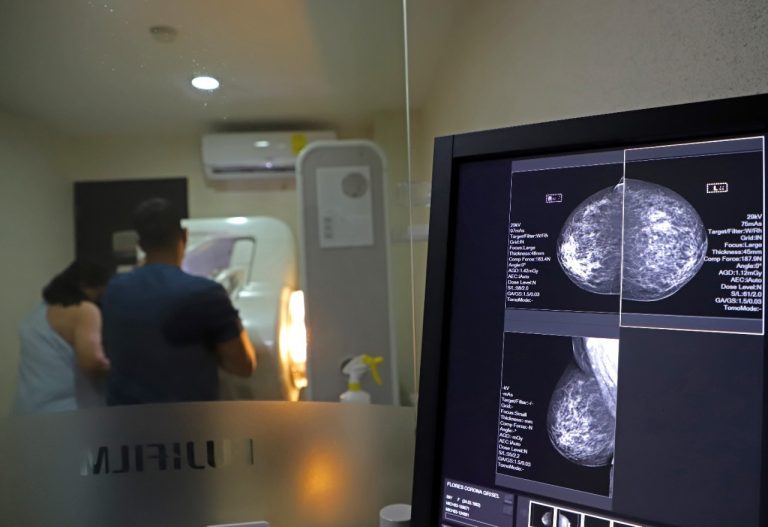 SSM lleva mastografías a 11 municipios para detección oportuna de cáncer de mama