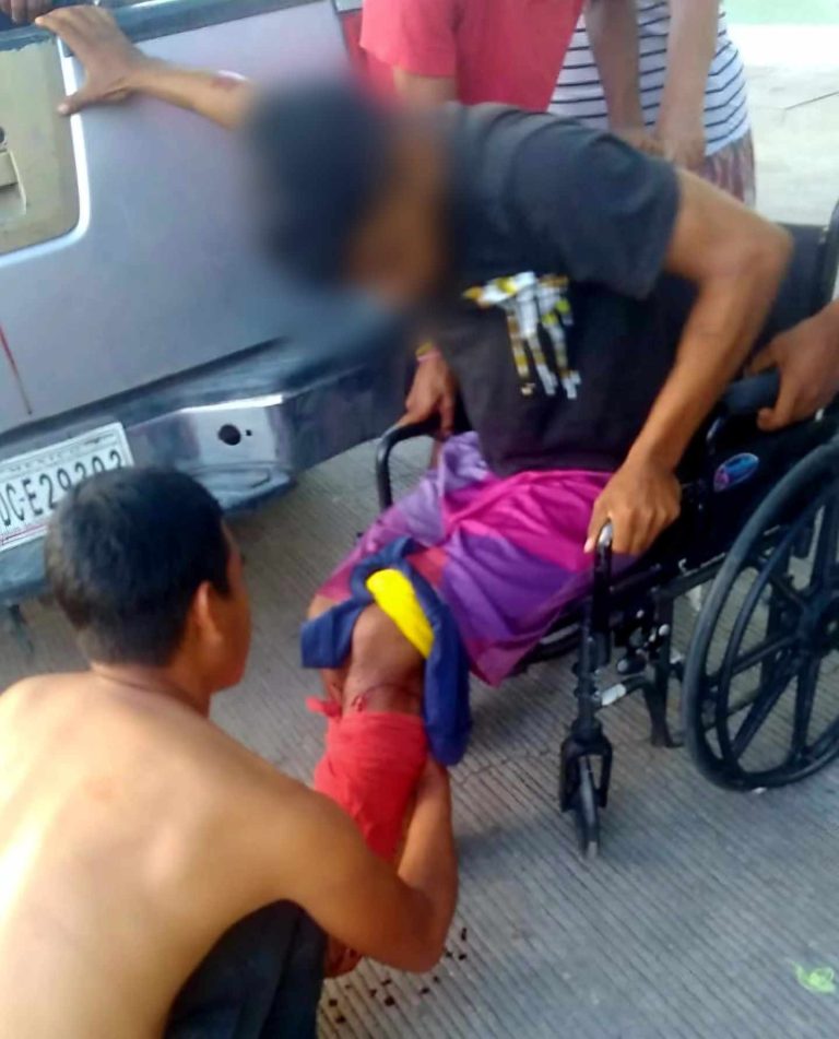 Vehículo desconocido embiste a motociclistas y huye; hay dos lesionados