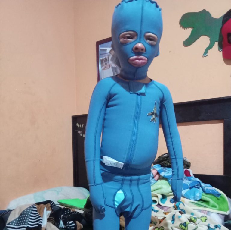 Chuchito lanza un llamado de auxilio: ¡Tu ayuda es vital!