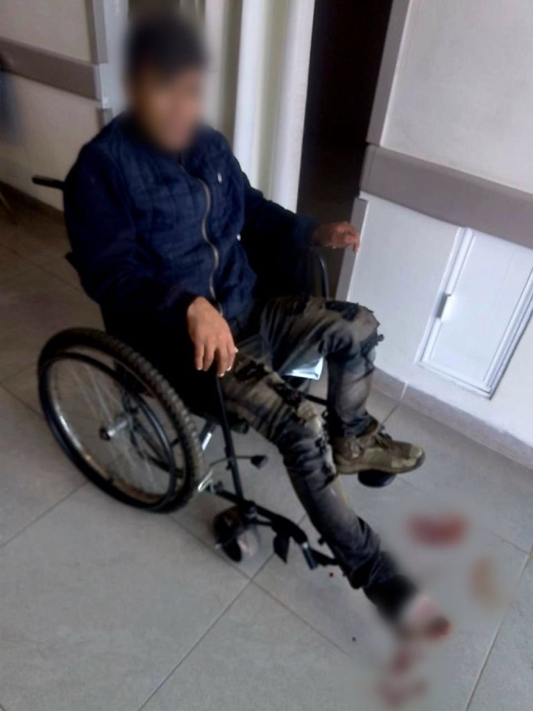 Balean a joven para robarle su moto, en Apatzingán