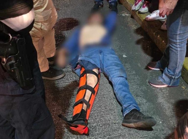 Adulto mayor es atropellado por motociclista desconocido