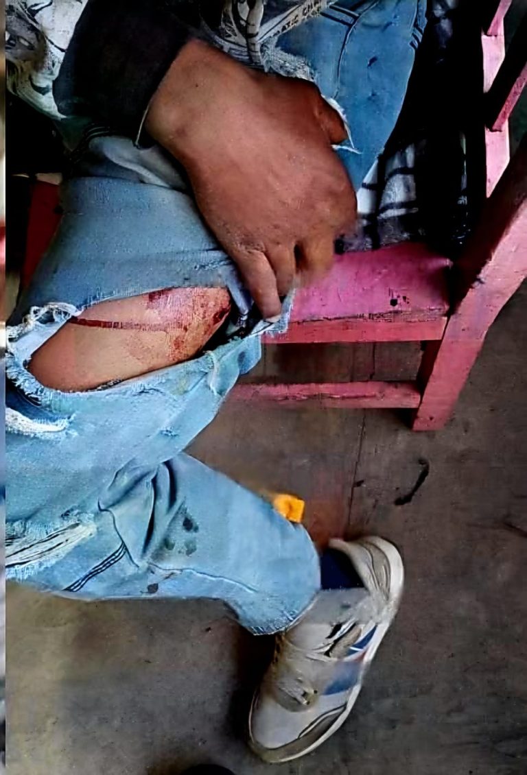 Balean a joven en colonia Lomas del Rosario, en Uruapan