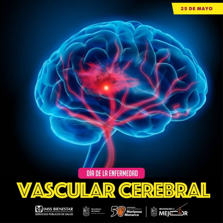 Cómo identificar signos de alarma de una enfermedad vascular cerebral: SSM