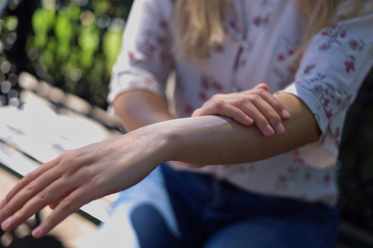 SSM comparte recomendaciones para prevenir quemaduras y deshidratación este verano