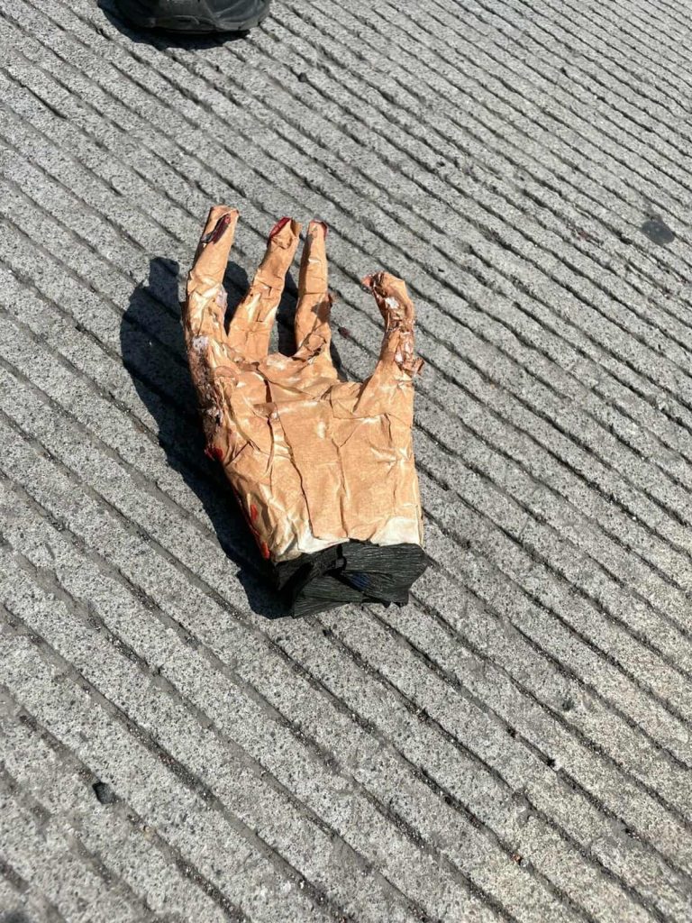 Reporte sobre hallazgo de mano humana moviliza a la Policía en Villas del Pedregal